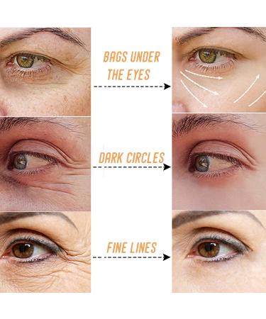 Verfons Firming Eye Cream Set - Reduces Bags, Dark Circles, and Wrinkles - Buy Online on GoSupps.com