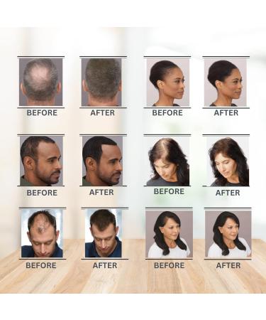  Best Hair Fiber 4 Packs 27.5g Dark Brown Natural Keratin Extract Hair Fibers For Full Hair - Buy Online on GoSupps.com