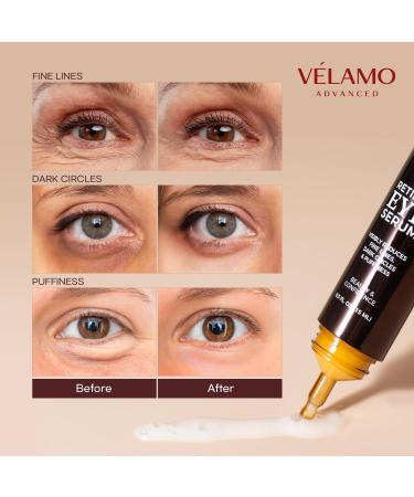 VELAMO ADVANCED Retinol Eye Serum with Caffeine Hyaluronic Acid Peptides and Ceramides 0.5 FL OZ/15 mL Pure-Golden-Brown - Buy Online on GoSupps.com