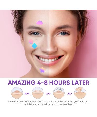 Senhorita 144Pcs Colorful Hydrocolloid Acne Patches with Green Algae Extract & Tea Tree Oil - Cover, Reduce Zits, Pimples, Blemishes - 144 Count - Buy Online on GoSupps.com