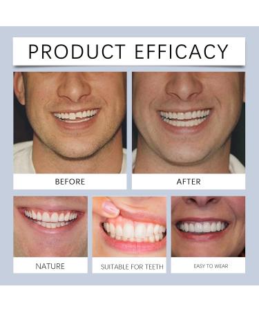 Invisible Teeth Brace For Smile Enhancement Comfort Fit Instant Results Easy To Use - Perfect For Teeth Gaps(2PC) - Buy Online on GoSupps.com