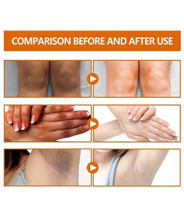 LONGLUAN Fivfivgo Advanced Skin Brightening Serum - Melanosis & Dark Spots Remover - Buy Online on GoSupps.com