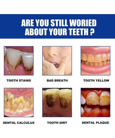 Miyanxi Probiotic Tooth Powder - Effective Teeth Whitening Powder for White Teeth - 50g - Buy Online on GoSupps.com