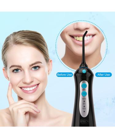 Cordless Water Flosser with 3 Modes & 4 Tips | Portable Oral Irrigator for Travel | IPX7 Waterproof Teeth Cleaner - Black - Buy Online on GoSupps.com