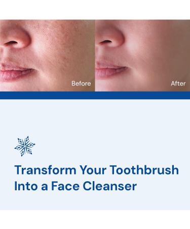 SNOW Electronic Face Brush Attachment | Sonic Vibrating Facial Cleansing Brush with Soft Silicone Bristles - Detachable Electric Massager for Men & Women - International Shipping Available - Buy Online on GoSupps.com