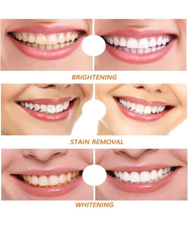 Celsky Paint Celsky Smile Tooth Paint Instant Teeth Whitening Paint Natural Teeth Whitening Paint Long Lasting Whitening No Sensitivity and Easy (2pcs) - Buy Online on GoSupps.com