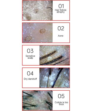 13inch Skin Scalp Detector Hair Skin Detector for Random Skin Hair Scalp Analysis MultiFunctional Rechargeable Hair Follicle Skin Analyser Machine(US) - Buy Online on GoSupps.com