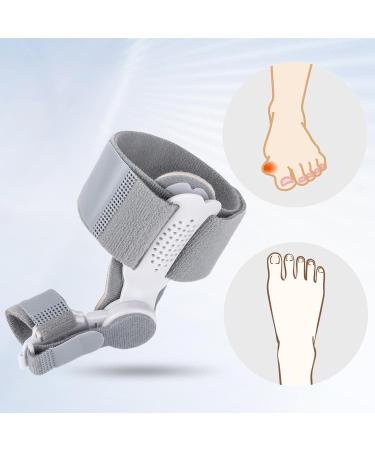 Qoier Bale Toe Correction Spreader - Foot Pain Relief & Orthopedic Solution for Overlapping Toes - Buy Online on GoSupps.com