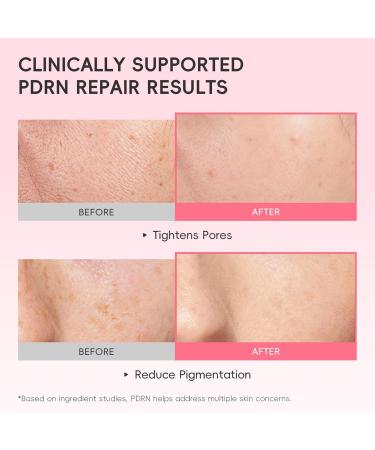  Grgowe Facial Serum Pink Peptide Serum Pink Glow Serum Hidratante Y Refirming Brightens Complexion Smooths Fine Lines Soothes Dryness Reduces Dull Suitable for All Skin Types - Buy Online on GoSupps.com