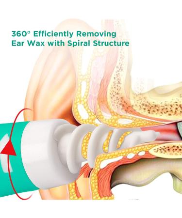 BALHVIT Spiral Ear Wax Removal Tool | Safe & Painless Earwax Remover with 16 Silicone Tips - Efficient Ear Cleaner for Kids & Adults - Buy Online on GoSupps.com