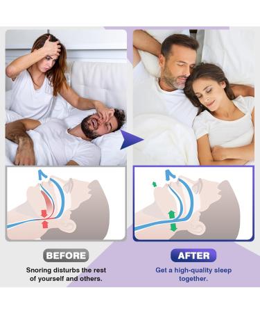 Buy Anti Snoring Devices - Adjustable Magnet Silicone Nose Clip for Quieter Sleep | Effective Snore Stopper - Buy Online on GoSupps.com