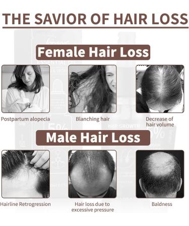 Natural Hair Growth Oil for All Hair Types - Nourishing Scalp Treatment (2pcs) - Buy Online on GoSupps.com