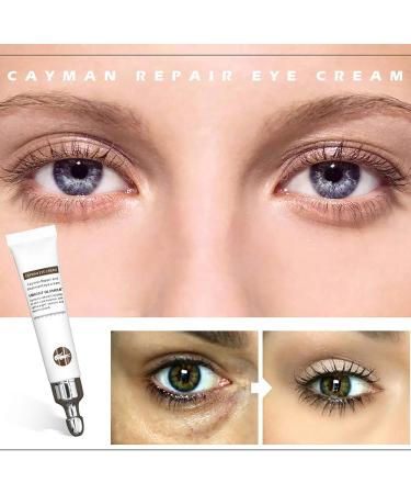 Yukong Eye Cream Magic Wrinkle Eye Serum Cream Remove Dark Circles & Eye Bags 20g - Buy Online on GoSupps.com