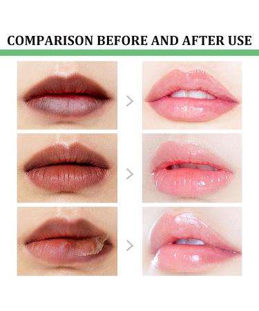 Lip Lightening For Dark Lips Moisturizing Lip Balms for Lip Care Long Lasting Natural Lip Plumper to Repair Cracked Lips and Remove Dark Lip Total Hydrating & Brightening - Buy Online on GoSupps.com