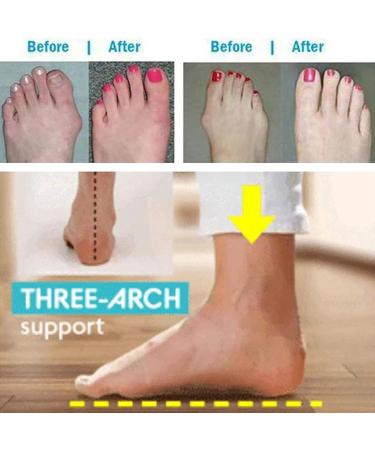 Bunion Corrector Beach Sandals - Women's Summer Strappy Flip Flops & Lightweight Orthopedic Slippers for Hallux Valgus - Buy Online on GoSupps.com