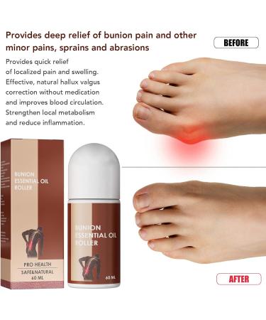 Natural 60ml Essential Toenail Roller Oil - Pain Relieving & Multi-Purpose Formula for Fast Repair - Buy Online on GoSupps.com