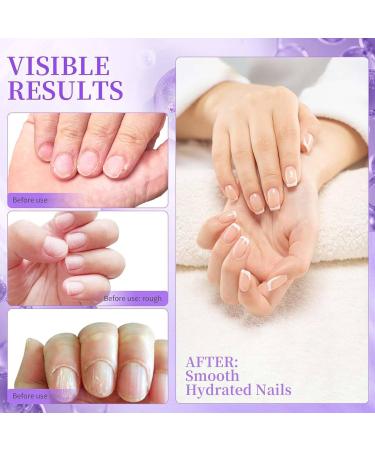 Sassytip 2 En 1 Stylo Repousse-Cuticules L'huile Sassytip Huile Cuticules Ongles Stylo Stylo Ongles 2 En 1 Pour Enlever Les Cuticules Stylo Huile De Cuticule Avec Pointe En C ramique (1PC) - Buy Online on GoSupps.com