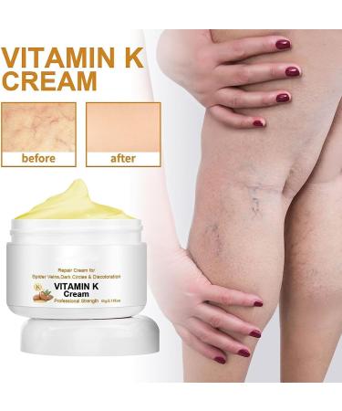 RWRAPS 2STK Fivfivgo Varicose Vein Miracle Cream - Improve Blood Circulation & Relieve Leg Discomfort - Buy Online on GoSupps.com