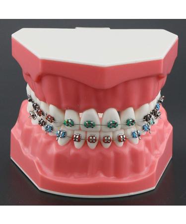 Dental Orthodontic Model with Metal Brackets, Arch Tubes, and Ligature Ties - Standard Size for Teaching and Study - Buy Online on GoSupps.com
