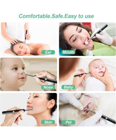 1080P FHD Wireless Earwax Removal Tool with Camera | Ear Otoscope Cleaner for Android, iPhone & iPad - Buy Online on GoSupps.com