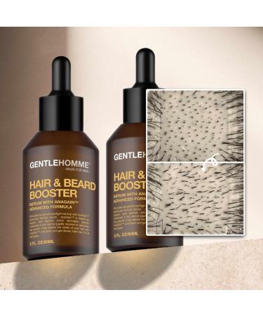 Anagain Hair & Beard Growth Serum - Advanced Biotin & Castor Oil Formula for Thicker Fuller Hair Regrowth - 60 mL - Buy Online on GoSupps.com