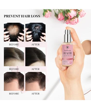 Biotin, Castor Oil & Rosemary Hair Growth Treatment Serum - Strengthen, Nourish, and Thicken Dry Damaged Hair - Buy Online on GoSupps.com