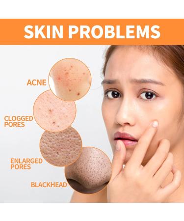 Organic Turmeric Facial Clay Stick Mask - Vitamin C Acne & Blackhead Remover for Men & Women | Skin Tightening & Pore Filler - Buy Online on GoSupps.com