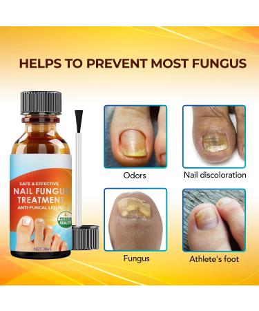 TOTCLEAR Nail Repair for Toenails and Fingernail Extra Strength Toenail and Fingernail Repair Liquid Nail Repair for Damaged Discolored Foot & Toenails Foot - Buy Online on GoSupps.com