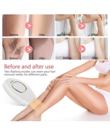 IPL Laser Hair Removal Device for Men & Women - 5 Energy Levels for Face Arms Legs & More - Buy Online on GoSupps.com