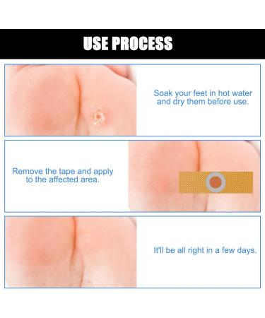 84 Corn Removal Pads - Effective Treatment for Chicken Eyes Foot Sole Corns and Warts - Buy Online on GoSupps.com