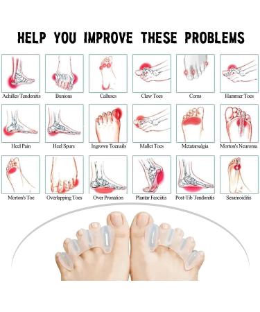 Medium Nude Toe Separators & Straighteners (1 Pair) for Men & Women - Bunion Corrector, Hammertoe Relief, Plantar Fasciitis - Size M - Buy Online on GoSupps.com