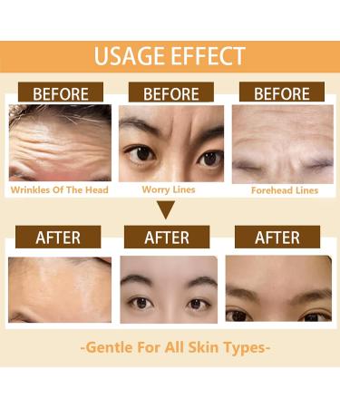Shop FDA Cleared Forehead Wrinkle Patches - 12 Pcs with Vitamin E & Aloe for Smooth Fine Lines & Wrinkles - Buy Online on GoSupps.com