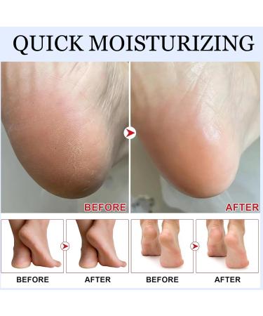 Cr me Pieds R paratrice Hydratante Cr me pour les Pieds Secs et Fissur s 40 g Baton Baume Pour Pied Gel nourrissante talons l'avocat Soin R parateur Anti-Fissures Hydratation profonde - Buy Online on GoSupps.com
