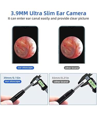 Ear Endoscope 2022 New 3-in-1 Otoscope Cleaner Ear Cleaner WiFi Endoscope Hilarious123 - Buy Online on GoSupps.com