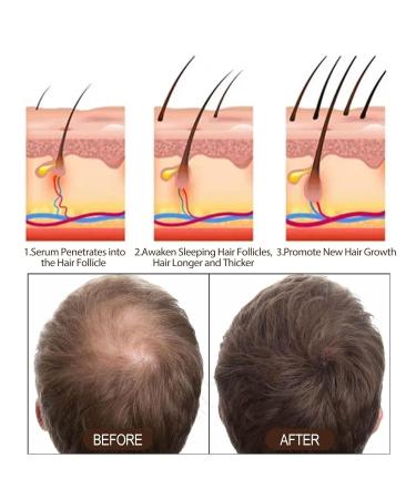 Keratin Hair Serum & Revitalizing Cream | Detangling & Curly Hair Care | Smooth & Shiny Hair (8 Pack - Buy Online on GoSupps.com