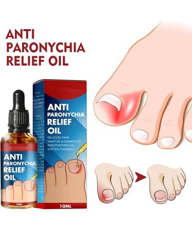 Ingrown Toenail Correction Oil - Drops - Softener for Easy Trimming | Type A - Buy Online on GoSupps.com
