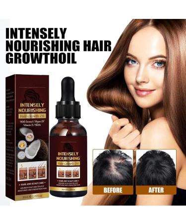  Raxove Coconut Hair Growth Oil Natural Hair Regrowth Oil 30ml for Women Men - Nutrition Hair Products to Improve Hair Health - Buy Online on GoSupps.com