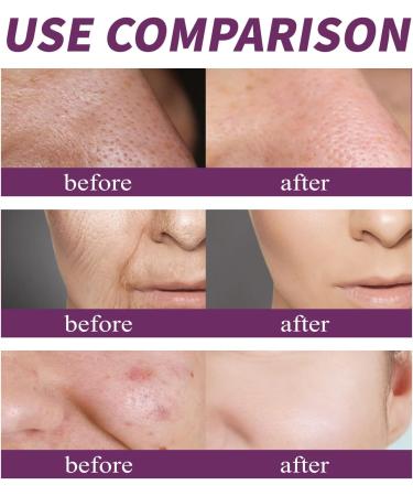  SKZKK Niacinamide Face Serum 20%: Brightening Firming Moisturizing Anti-Wrinkle Evening Smoothing Fine Lines Reducing Pigmentation Pore Care for Sensitive Skin (2pcs) - Buy Online on GoSupps.com