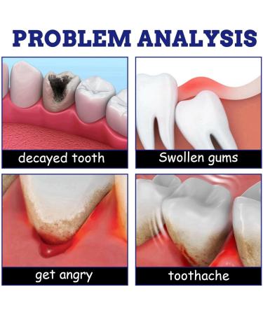 Toothache Relieving Spray Tooth Pain Relief Instant Teeth Treatment Relief Toothache Sprays Rapid Relief Dental Spray Toothache Muscle Pain Sprays Remedies Teeth & Gums Spray Oral Care Spray - Buy Online on GoSupps.com