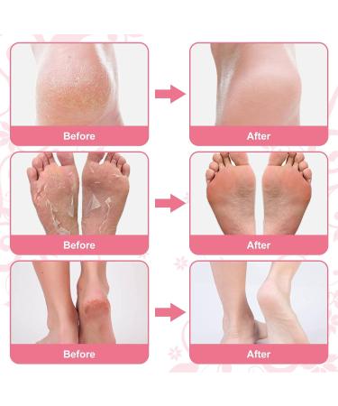Pack Foot Peeling Mask | Lavender Exfoliating Foot Scrub for Soft Smooth Skin | Dead Skin Remover for Men & Women - Buy Online on GoSupps.com