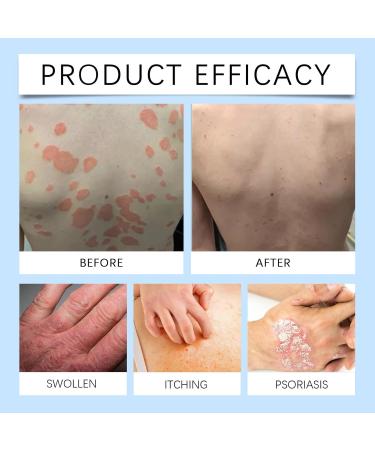 Itchaway Cream skin care cream mild nonirritating gently softens and hydrates the skin suitable for all skin types 1 Pieces - Buy Online on GoSupps.com