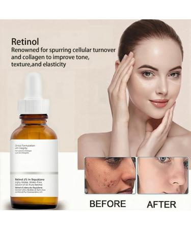 30ml Retinol 1% in Squalane Skincare Retinol Serum for Face Hyaluronic Acid Serum for Activate Skin High Strength for Face Reduce Fine Lines & Wrinkle Face Serum for Women Anti Aging Facial Serum - Buy Online on GoSupps.com