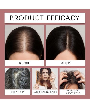  homomdy Organic Onion Shampoo for Hair Growth Natural Tea Tree Oil Shampoo with Rosemary for Stronger Thicker Less Hair Loss and Breakage - Buy Online on GoSupps.com