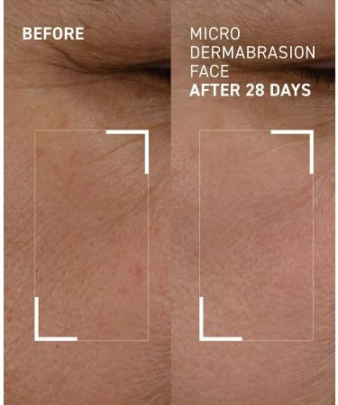 Dr. Brandt Microdermabrasion Renewing Age-Defying Face Exfoliator - 2.0 oz - Buy Online on GoSupps.com