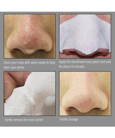 BOOBEES NASES LITE - Deep Cleaning Blackhead Remover Pore Strips | Oil-Free & Non-Comedogenic Solution for Clear Skin - Buy Online on GoSupps.com