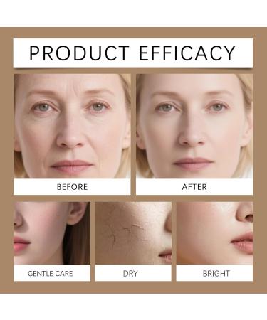 S rum Concentr Anti-Taches Visage Serum Vitamine C - Enrichi en Vitamine C + B + E Skin Care Cor enne les Teints Ternes - Contour Des Yeux Anti-Rides et Anti-Cernes Serum Hydratant Visage - 30 ml - Buy Online on GoSupps.com