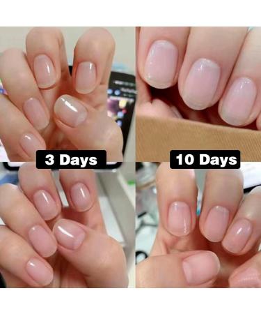 ASMAYSA Keratin 3 Day Growth Nail Treatment - Nail Strengthener and Nail Growth - Fast Keratin Nail Hardener & Nail Strengthener for Thin Nails Brittle & Damaged Maximum Strength Formula 15ml 3 Days Nail Growth - Buy Online on GoSupps.com