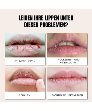  ARCHIDATE Color-changing lip balm moisturizing and brightening lipstick with hyaluronic acid and gold leaf for softer fuller lips. - Buy Online on GoSupps.com