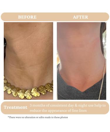 Shop Retinol Alternative Serum | Best Anti-Aging Solution for Radiant Skin - Free International Shipping - Buy Online on GoSupps.com