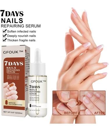 7 Days Of Nail Growth And Strengthening Essence 3PCs 20ml Nail Repair Essence Color Changing Nails Nails Quickly Grow And Repair Damaged Nail Polish - Buy Online on GoSupps.com